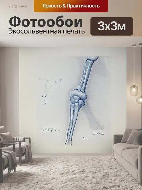 Фотообои описание рентгеновского снимка в стиле научной иллюстрации