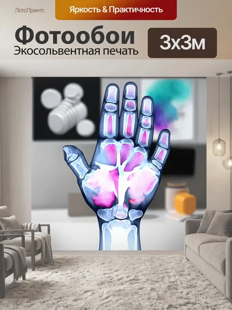 Фотообои рентгеновский снимок руки
