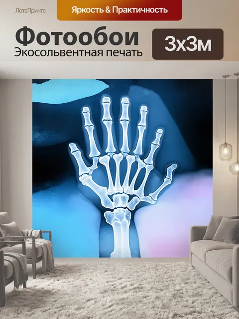 Фотообои рентгеновский снимок руки