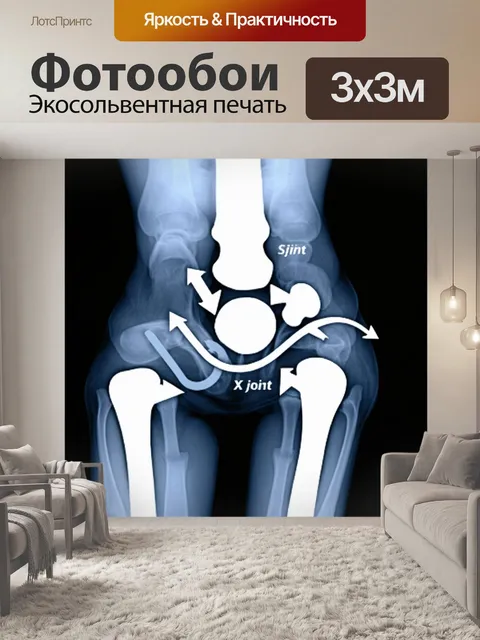 Фотообои рентгеновское изображение тазобедренного сустава