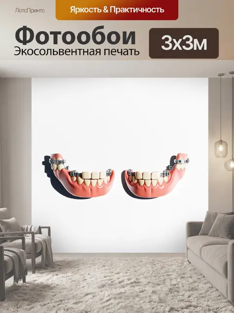 Фотообои фотография в стиле минимализма, где на белом фоне изображены две верхние челюсти с брекетами