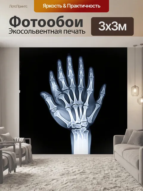 Фотообои рентгеновский снимок кисти