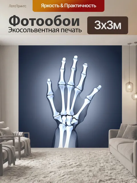 Фотообои рентгеновский снимок руки с акцентом на поблескивающие суставы и кости, выполненный в стилистике минимализма