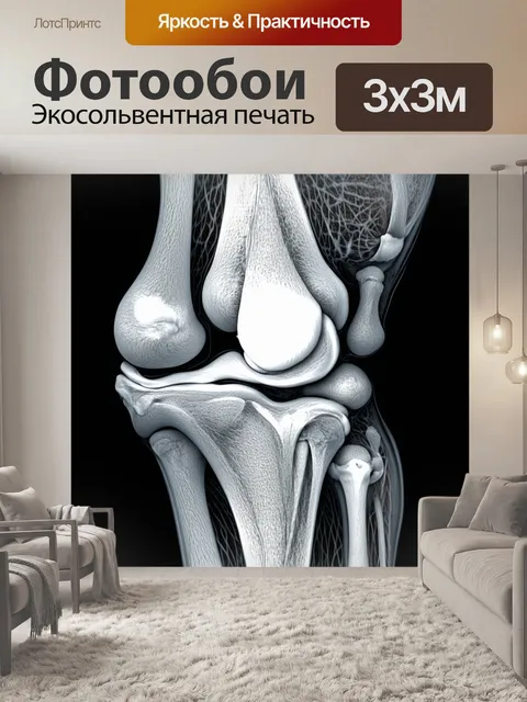 Фотообои мрт-изображение коленного сустава с акцентом на хрящи и связки, выполненное в технике гиперреализма