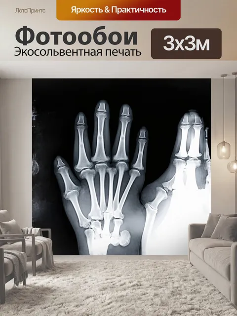 Фотообои рентгеновский снимок кисти, имеющий вид классической черно-белой фотографии с высокой контрастностью