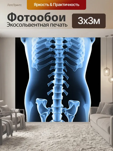 Фотообои рентгеновское изображение позвоночника