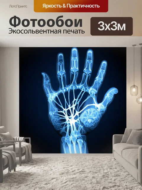 Фотообои рентгеновское изображение руки