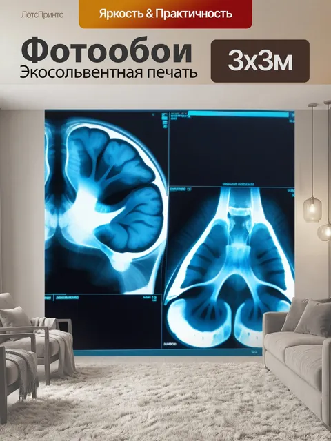 Фотообои изучение рентгенограмм для определения кариеса