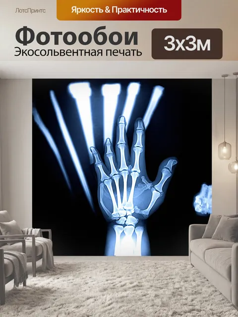 Фотообои рентгеновский снимок руки на черном фоне