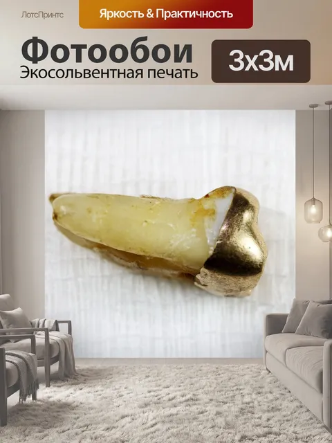 Фотообои выдернутый моляр с кариесом и золотом