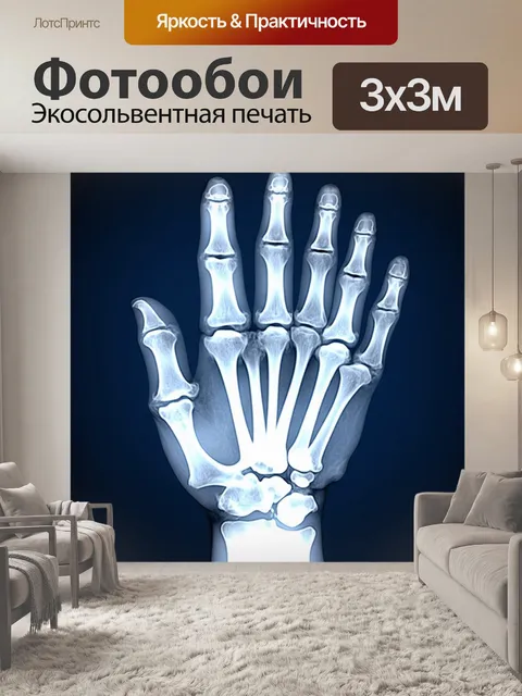 Фотообои изображение рентгеновского снимка руки