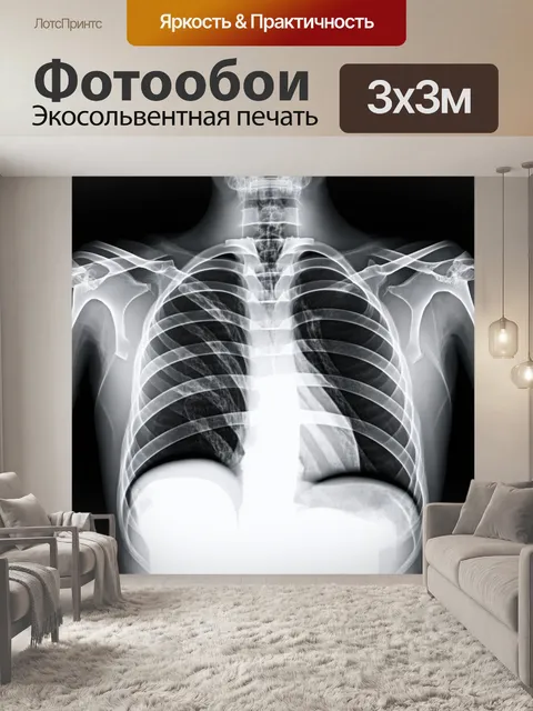 Фотообои художественное изображение рентгеновского снимка