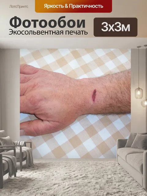 Фотообои Гаш рану на руке