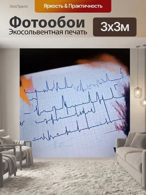 Фотообои в центре сюжета — сложная экг-диаграмма