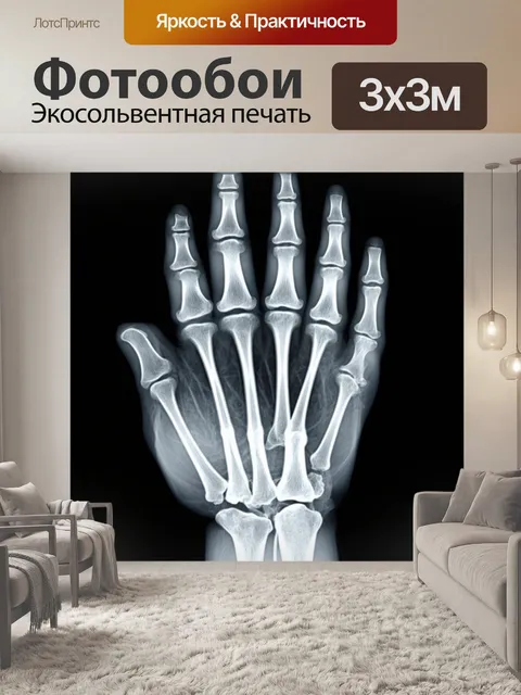 Фотообои рентгеновский снимок человеческой кисти, на котором четко видны кости, суставы и мягкие ткани