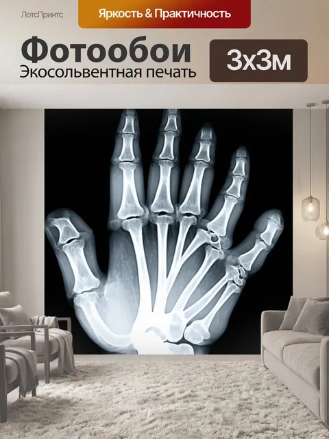 Фотообои рентгеновский снимок, показывающий детали кисти руки, выполненное в технике черно-белой графики