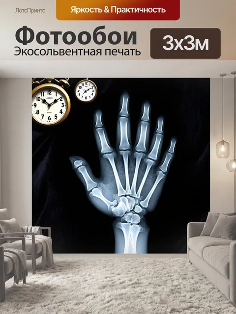 Фотообои рентгеновское изображение руки на фоне черного бархата