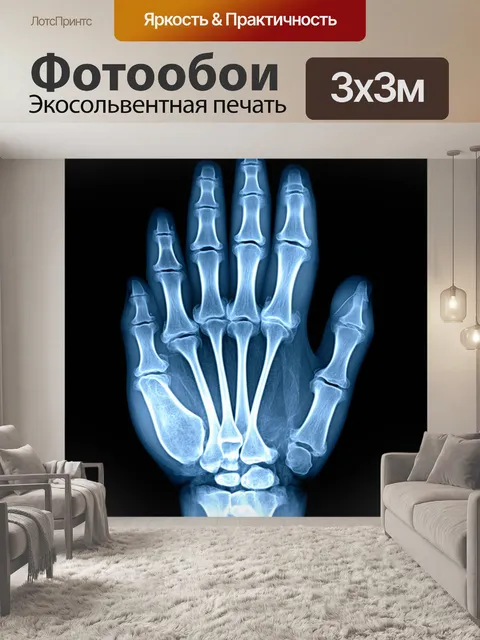 Фотообои рентгеновское изображение человеческой руки, на котором четко видно кости и мягкие ткани