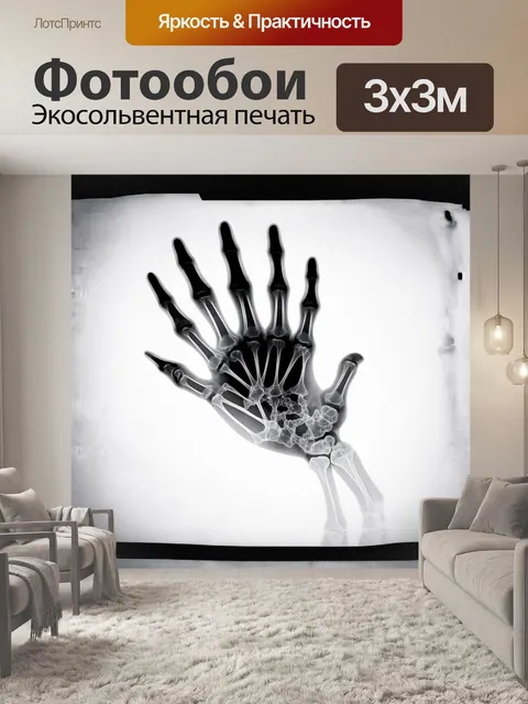 Фотообои рентгеновский снимок руки