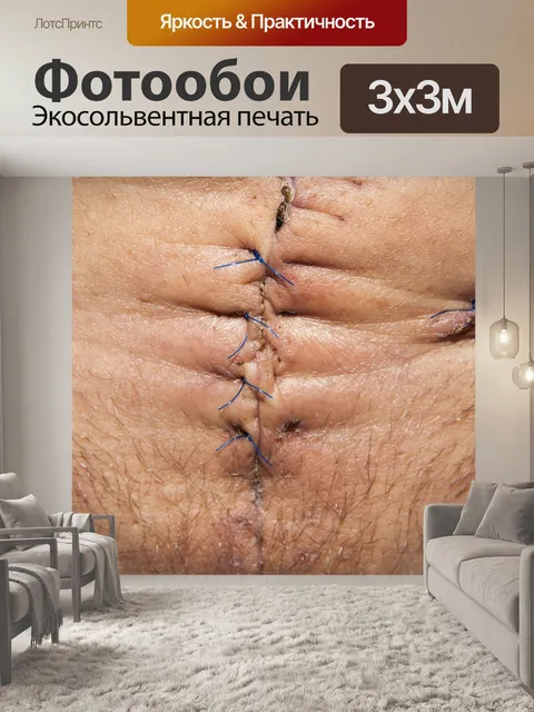 Фотообои Op