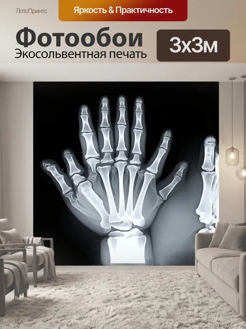 Фотообои рентгеновский снимок человеческой руки