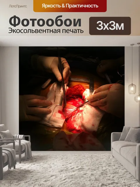 Фотообои Операция