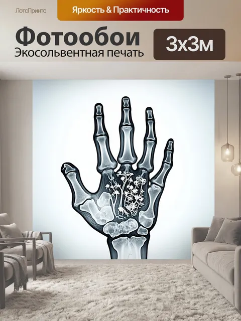 Фотообои микроскопическое рентгеновское изображение руки