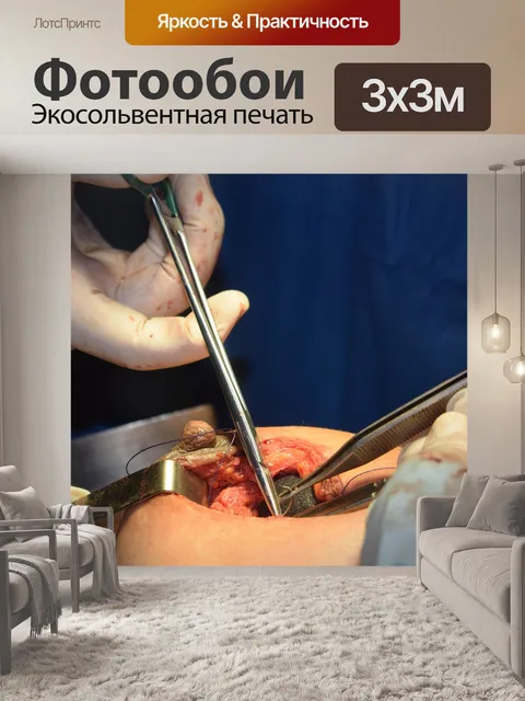Фотообои Маммопластика