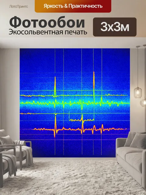 Фотообои на переднем плане — экг-диаграмма с яркими
