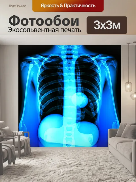 Фотообои рентгеновское изображение грудной клетки на синем фоне