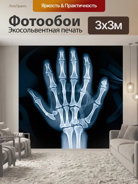 Фотообои рентгеновское изображение руки
